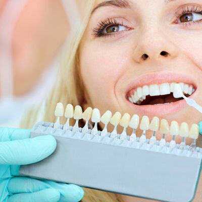 4 Common Types of Dental Implants and Their Costs