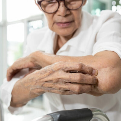 Itchy Skin in Seniors &#8211; Causes, Symptoms, and Management