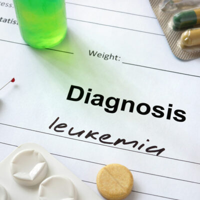 Acute Myeloid Leukemia &#8211; Stages, Types, Symptoms, Causes, and Therapies