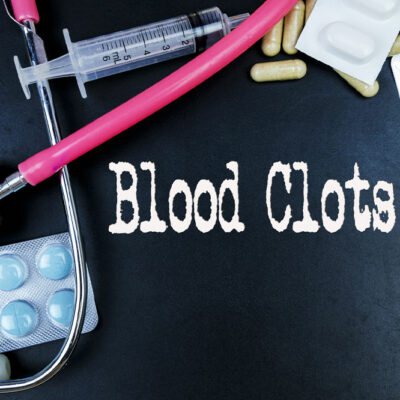 Blood Clotting Disorders &#8211; Symptoms, Causes, and More