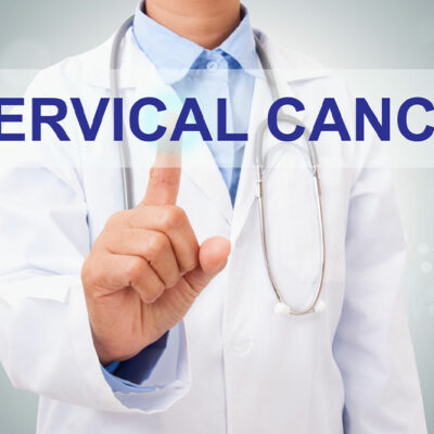 Cervical Cancer &#8211; Causes, Risk Factors, Symptoms and More