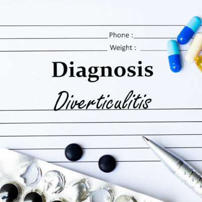 Diverticulitis &#8211; Causes, Symptoms, and How to Manage the Condition