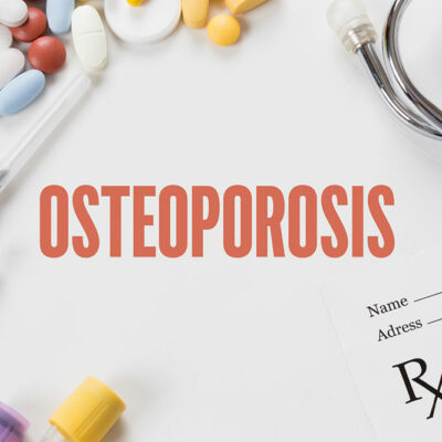 Things to Know About Osteoporosis Management