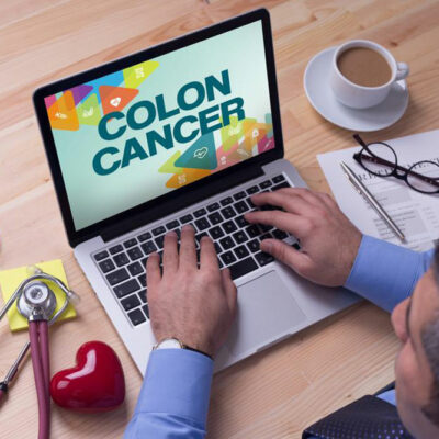 Colon Cancer: Top 3 Signs and Related Symptoms