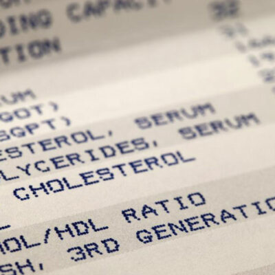 Differences between HDL and LDL that everyone should know