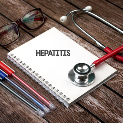 Hepatitis C – Causes, Symptoms, and Treatment