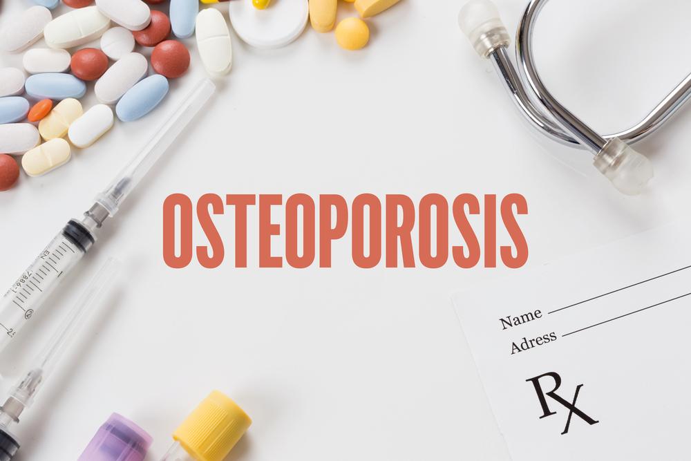 Introduction and Prevalence of Osteoporosis