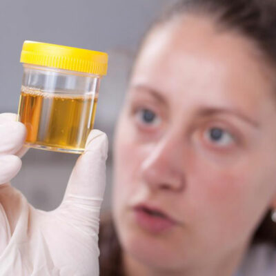 Types of urine colors and what they indicate