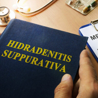 All You Need to Know about Hidradenitis Suppurativa