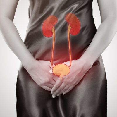 An Overview Of A Bladder Infection Causes, Symptoms, And Treatment