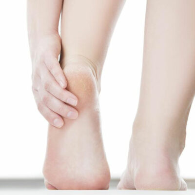 Effective Ways to Treat Diabetic Feet Problems