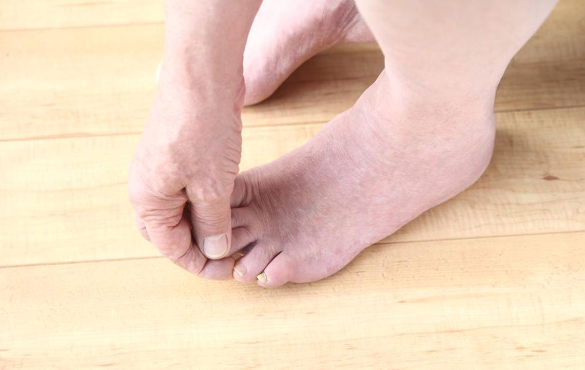 Fibromyalgia Foot Pain &#8211; Factors to Understand