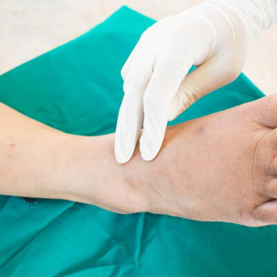 How to Alleviate Your Diabetes Foot Problems