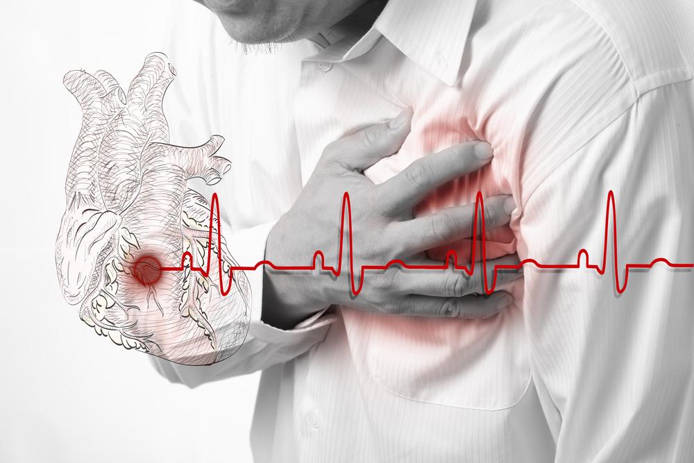 Symptoms And Treatment For Atrial Fibrillation