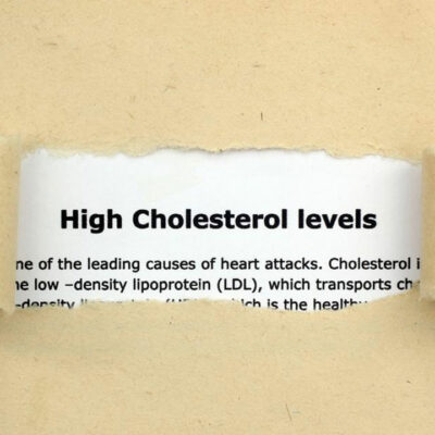 Things You Need to Know about Cholesterol Levels