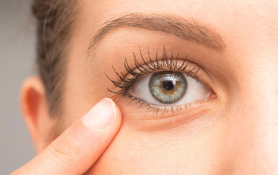 10 Tips to Remove Under-Eye Bags