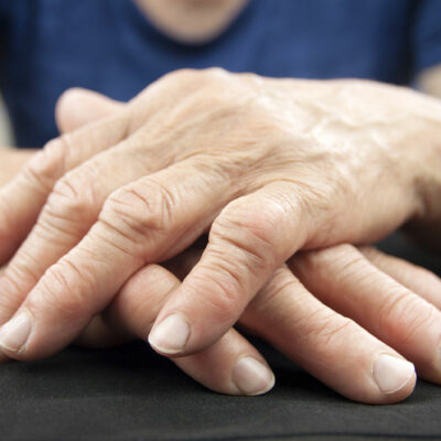 7 tips for living better with rheumatoid arthritis